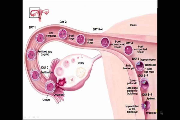 Implantation-After-IUI-INTRAUTERINE-INSEMINATION