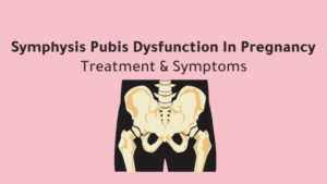 Symphysis Pubis Dysfunction In Pregnancy