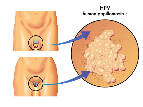 HPV-vaccine-boys-girls