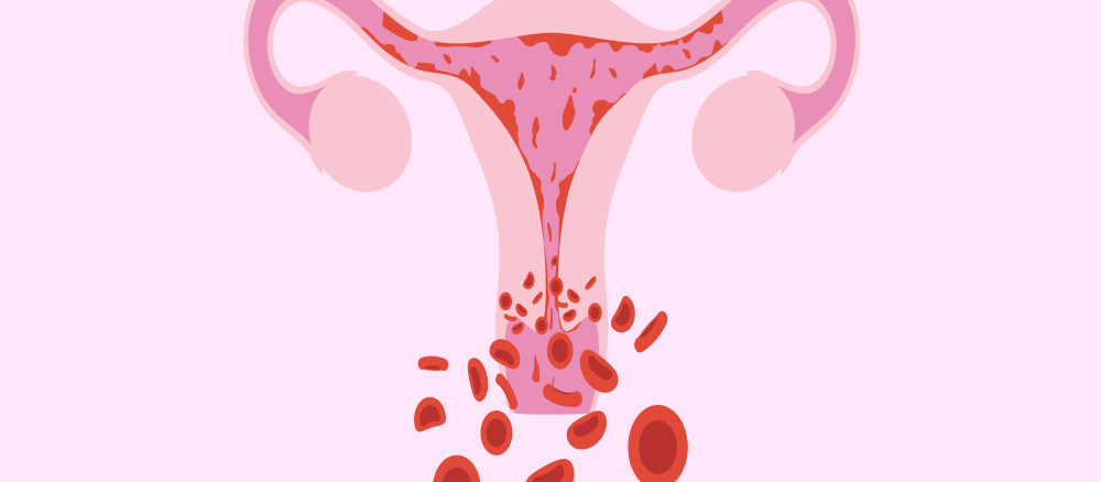 Signs-And-Symptoms-Of-Pregnancy-After-Endometrial-Ablation