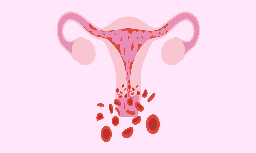 Signs-And-Symptoms-Of-Pregnancy-After-Endometrial-Ablation